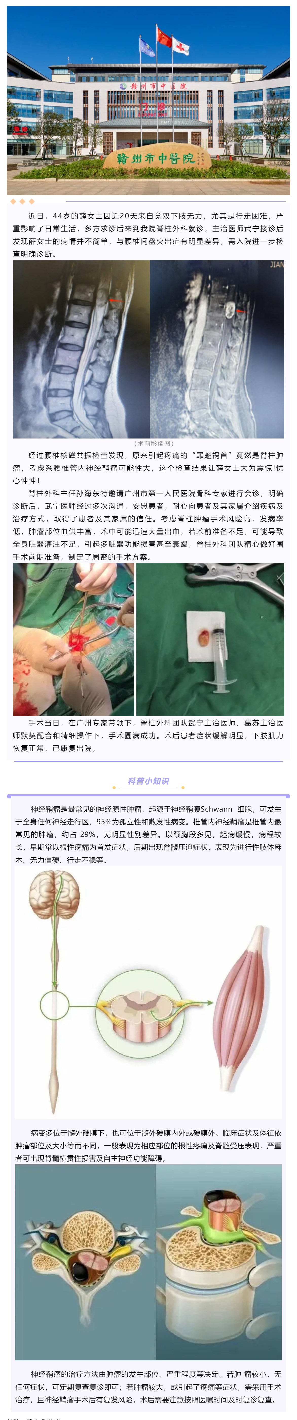 腰腿痛、下肢乏力麻木，提防神經(jīng)鞘瘤！.png