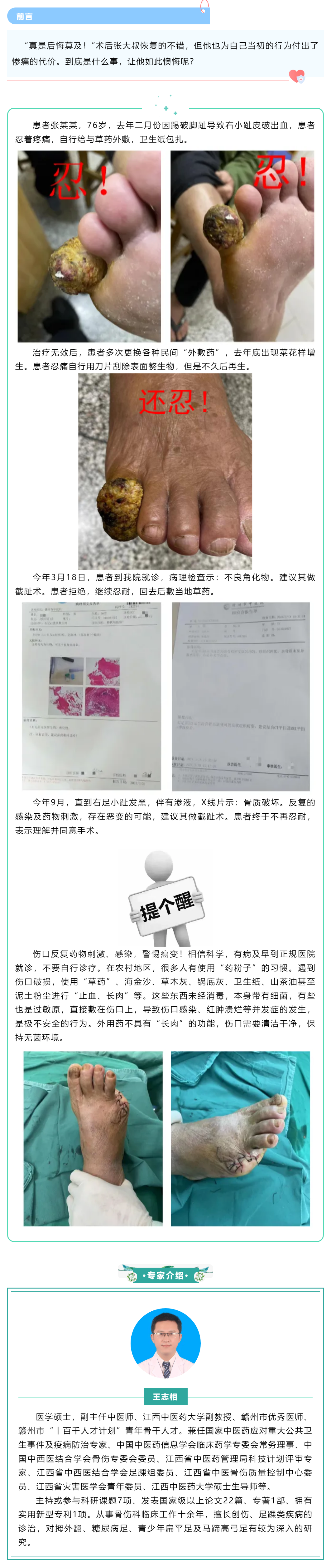 【病案實錄】小病忍、忍、忍，大病吃苦頭，多么痛的領悟！.png