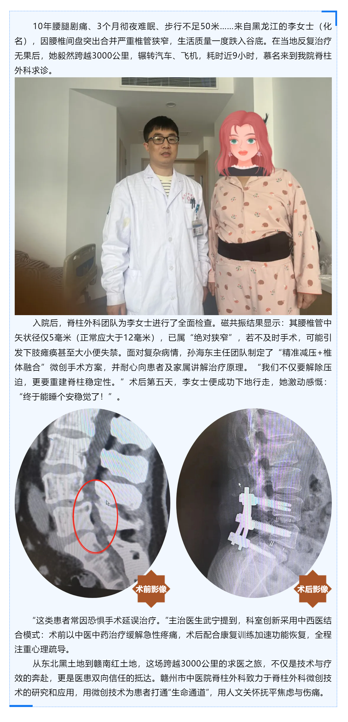 跨越山河的信任_贛州市中醫(yī)院巧手“疏堵”，腰椎狹窄患者3000公里求醫(yī)路終迎新生！.png